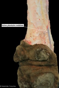 post vue plantaire médiale annoté
